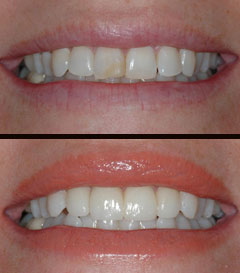 cosmetic dentist before after